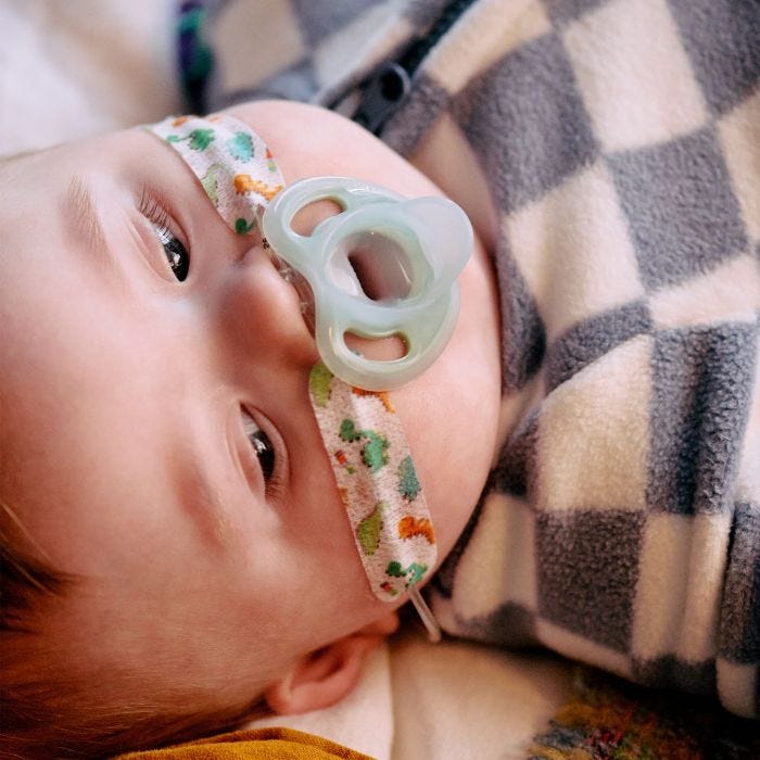 Baby with feeding tube laying down with ultralight pacifier in their mouth